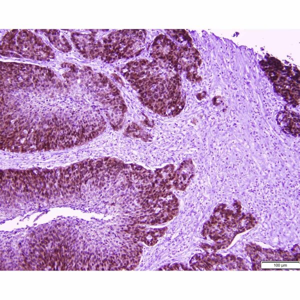 Tissue Control Slide, HPV for IHC
